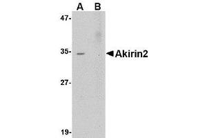 Western blot analysis of Akirin2 in Human Brain tissue lysate with AP30041PU-N Akirin2 antibody at 0. (AKIRIN2 anticorps  (Center))