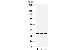 Western blot testing of 1) rat testis, 2) human 22RV1 and 3) human SKOV lysate with Smac antibody.