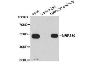 Immunoprecipitation analysis of 200ug extracts of HepG2 cells using 1ug MRPS30 antibody.
