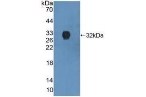 Detection of Recombinant ANXA6, Human using Polyclonal Antibody to Annexin A6 (ANXA6)