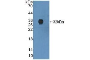 Detection of Recombinant ANXA6, Human using Polyclonal Antibody to Annexin A6 (ANXA6) (ANXA6 anticorps  (AA 2-251))