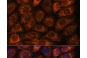 Immunofluorescence analysis of HeLa cells using CCT6B Polyclonal Antibody at dilution of 1:100. (CCT6B anticorps)