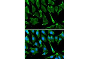 Immunofluorescence analysis of A549 cells using BRCA1 antibody. (BRCA1 anticorps  (AA 120-220))