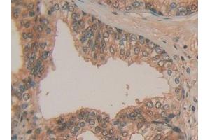 Detection of HPRT1 in Human Prostate Tissue using Polyclonal Antibody to Hypoxanthine Phosphoribosyltransferase 1 (HPRT1)