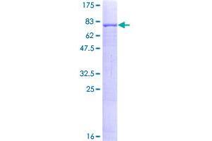 Image no. 1 for Angiopoietin-Like 1 (ANGPTL1) (AA 24-491) protein (GST tag) (ABIN1345049)