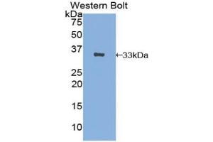 Detection of Recombinant AE1, Human using Polyclonal Antibody to Band 3 (BND3)
