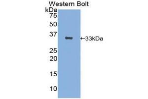 Detection of Recombinant AE1, Human using Polyclonal Antibody to Band 3 (BND3) (Band 3/AE1 anticorps  (AA 35-290))