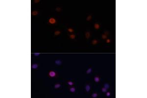 Immunofluorescence analysis of C6 cells using CDKN1A/p21CIP1 antibody (ABIN3022005, ABIN3022006, ABIN3022007 and ABIN6218565) at dilution of 1:100.