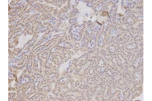 Immunohistochemistry (IHC) image for anti-Thymopoietin (TMPO) antibody (ABIN1875122) (Thymopoietin anticorps)