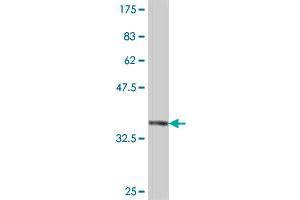 Western Blot detection against Immunogen (37. (FBXW8 anticorps  (AA 499-598))