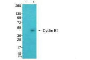 Western blot analysis of extracts from A549 cells (Lane 2), using Cyclin E1 antiobdy.