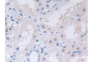 Detection of TFR2 in Human Kidney Tissue using Polyclonal Antibody to Transferrin Receptor 2 (TFR2)