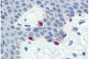 Human Skin, Melanocytes (formalin-fixed, paraffin-embedded) stained with MLANA antibody ABIN573958 at 10 ug/ml followed by biotinylated goat anti-rabbit IgG secondary antibody ABIN481713, alkaline phosphatase-streptavidin and chromogen. (MLANA anticorps  (C-Term))