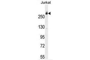 CAD Antibody (Center) western blot analysis in Jurkat cell line lysates (35µg/lane).