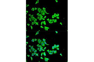 Immunofluorescence analysis of HeLa cells using SERPINB1 antibody.