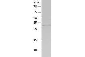 Western Blotting (WB) image for C1q and Tumor Necrosis Factor Related Protein 3 (C1QTNF3) (AA 23-319) protein (His-IF2DI Tag) (ABIN7122067)
