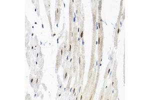 Immunohistochemistry of paraffin-embedded rat heart using SNRPF Rabbit pAb (ABIN6132678, ABIN6148228, ABIN6148229 and ABIN6215753) at dilution of 1:200 (40x lens). (SNRPF anticorps  (AA 1-86))