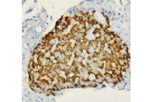 Image no. 1 for anti-Fatty Acid Binding Protein 1, Liver (FABP1) (N-Term) antibody (ABIN1495134) (FABP1 anticorps  (N-Term))