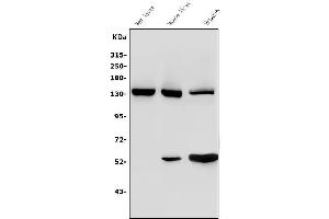 Western blot analysis of Ceruloplasmin/CP using anti-Ceruloplasmin/CP antibody (ABIN3044508). (Ceruloplasmin anticorps  (AA 20-258))