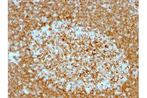 Formalin-fixed, paraffin-embedded human Tonsil stained with CD74 Mouse Monoclonal Antibody (LN-2 + CLIP/813). (CD74 anticorps)