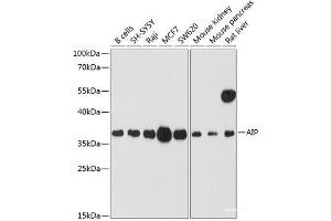 Western blot analysis of extracts of various cell lines using AIP Polyclonal Antibody at dilution of 1:1000. (AIP anticorps)