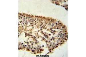 Immunohistochemistry (IHC) image for anti-ERO1-Like beta (ERO1LB) antibody (ABIN3002267)