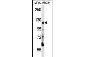 PITRM1 Antibody (Center) (ABIN656324 and ABIN2845623) western blot analysis in MDA-M cell line lysates (35 μg/lane). (PITRM1 anticorps  (AA 490-518))