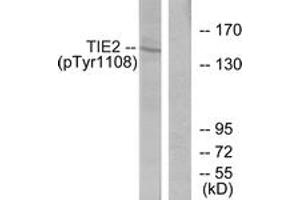 Western blot analysis of extracts from NIH-3T3 cells, using TIE2 (Phospho-Tyr1108) Antibody. (TEK anticorps  (pTyr1108))