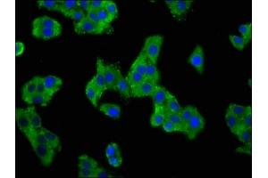 Immunofluorescence staining of HepG2 cells with ABIN7143000 at 1:100, counter-stained with DAPI. (ACCN1 anticorps  (AA 197-345))