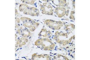 Immunohistochemistry of paraffin-embedded human gastric using SCG3 antibody at dilution of 1:100 (x40 lens).