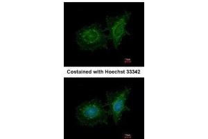 ICC/IF Image Immunofluorescence analysis of methanol-fixed HeLa, using SH3BP1, antibody at 1:200 dilution. (SH3BP1 anticorps  (C-Term))