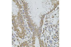Immunohistochemistry of paraffin-embedded human stomach using HMMR antibody (ABIN5971368) at dilution of 1/100 (40x lens). (HMMR anticorps)