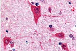 Human Brain, Cortex (formalin-fixed, paraffin-embedded) stained with GPR61 antibody ABIN213359 at 10 ug/ml followed by biotinylated goat anti-rabbit IgG secondary antibody ABIN481713, alkaline phosphatase-streptavidin and chromogen.