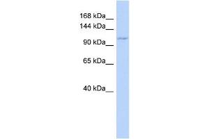 Western Blotting (WB) image for anti-Zinc Finger CCCH-Type Containing 7B (ZC3H7B) antibody (ABIN2457916)