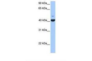 Image no. 1 for anti-FGFR1 Oncogene Partner (FGFR1OP) (AA 81-130) antibody (ABIN6738876) (FGFR1OP anticorps  (AA 81-130))