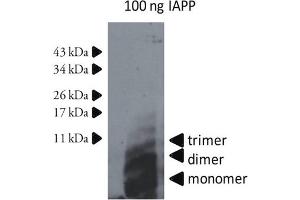 Western Blotting (WB) image for anti-Islet Amyloid Polypeptide (IAPP) antibody (ABIN334637)