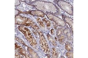 Immunohistochemical staining of human stomach with ZSWIM4 polyclonal antibody  shows granular cytoplasmic positivity in glandular cells at 1:50-1:200 dilution. (ZSWIM4 anticorps)