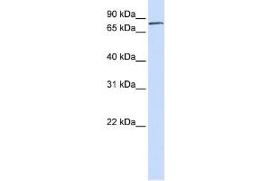 WB Suggested Anti-FERMT1 Antibody Titration:  0. (FERMT1 anticorps  (N-Term))