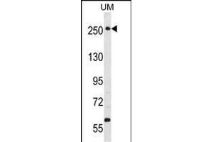 PRKWNK3 Antibody (ABIN391067 and ABIN2841218) western blot analysis in uterus tumor cell line lysates (35 μg/lane). (WNK3 anticorps  (C-Term))