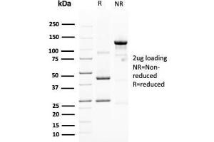 SDS-PAGE Analysis Purified MUC4 Mouse Monoclonal Antibody (MUC4/3105). (MUC4 anticorps  (AA 1730-1864))