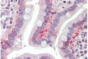 Human Small Intestine: Formalin-Fixed, Paraffin-Embedded (FFPE)