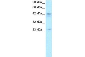 WB Suggested Anti-ZNF365 Antibody Titration:  0.