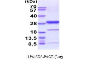 SDS-PAGE (SDS) image for Ubiquitin Carboxyl-terminal Esterase L1 (Ubiquitin Thiolesterase) (UCHL1) (AA 1-223) (Active) protein (His tag) (ABIN6388012)