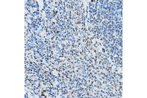 Immunohistochemistry of paraffin-embedded rat spleen using NCOR2 Rabbit pAb (ABIN6130575, ABIN6144422, ABIN6144423 and ABIN6224431) at dilution of 1:100 (40x lens).