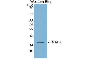 Western Blotting (WB) image for anti-Angiogenic Factor with G Patch and FHA Domains 1 (AGGF1) (AA 406-501) antibody (ABIN1866581) (AGGF1 anticorps  (AA 406-501))