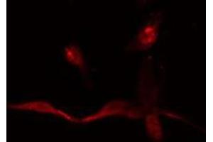 ABIN6275065 staining  HepG2 cells by IF/ICC.