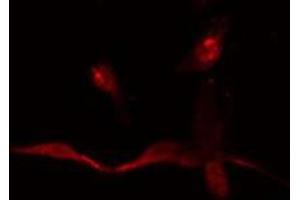 ABIN6275065 staining  HepG2 cells by IF/ICC. (TdT anticorps  (Internal Region))