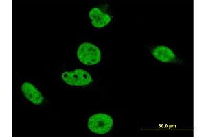 Immunofluorescence of monoclonal antibody to CRKRS on HeLa cell. (CDK12 anticorps  (AA 1281-1380))