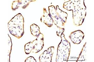 IHC analysis of RPL11 using anti-RPL11 antibody (ABIN7602315). (RPL11 anticorps  (AA 7-178))