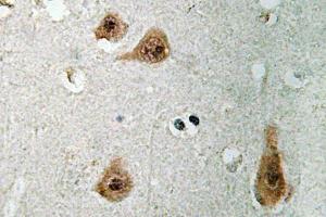Immunohistochemistry (IHC) analyzes of Annecin I antibody in paraffin-embedded human brain tissue. (Annexin a1 anticorps)